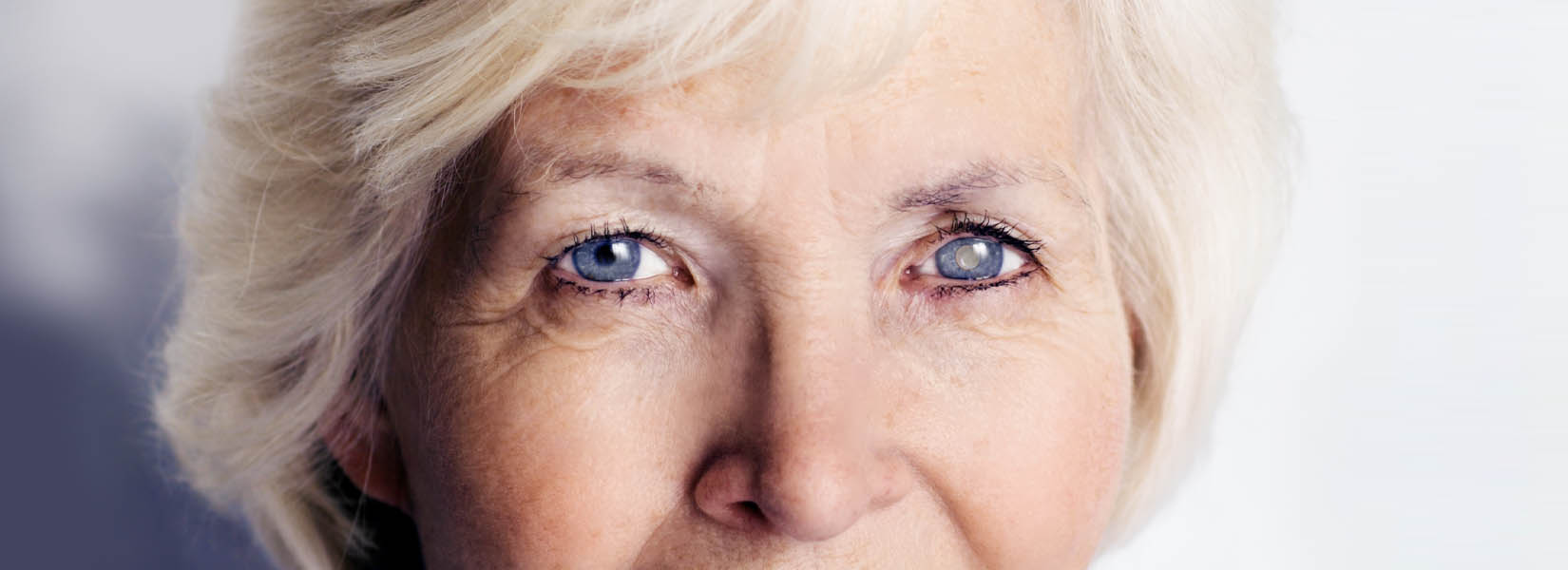 Cataract Surgery in Bryan